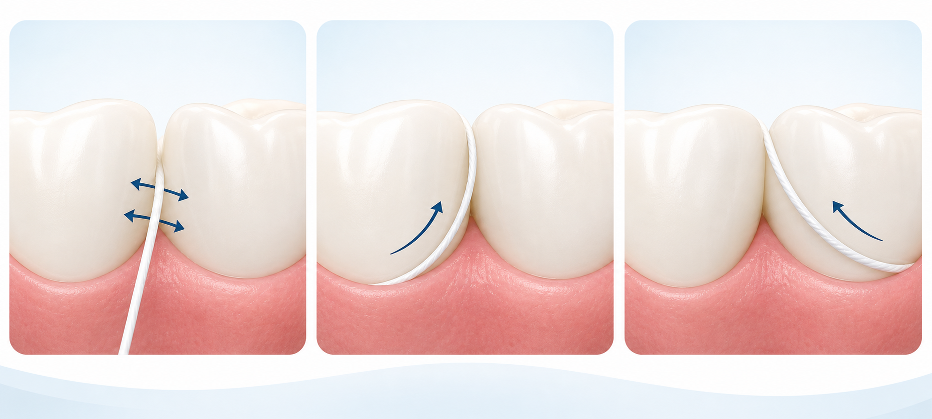 Three stages showing floss guided gently between two teeth, curved around one tooth, and then curved around the neighboring tooth.