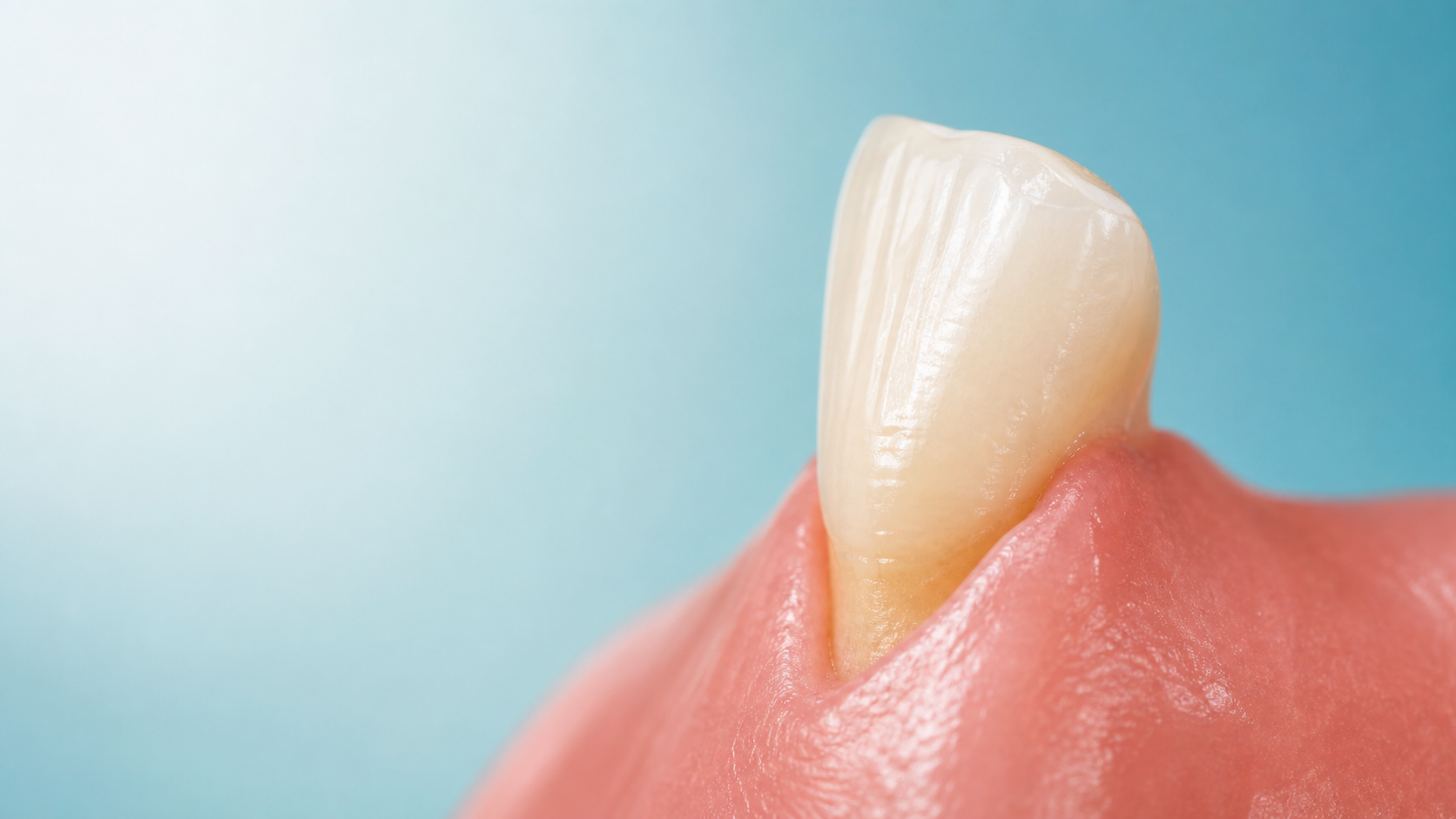 A close-up dental illustration showing a lowered gumline exposing a small area near the tooth root.